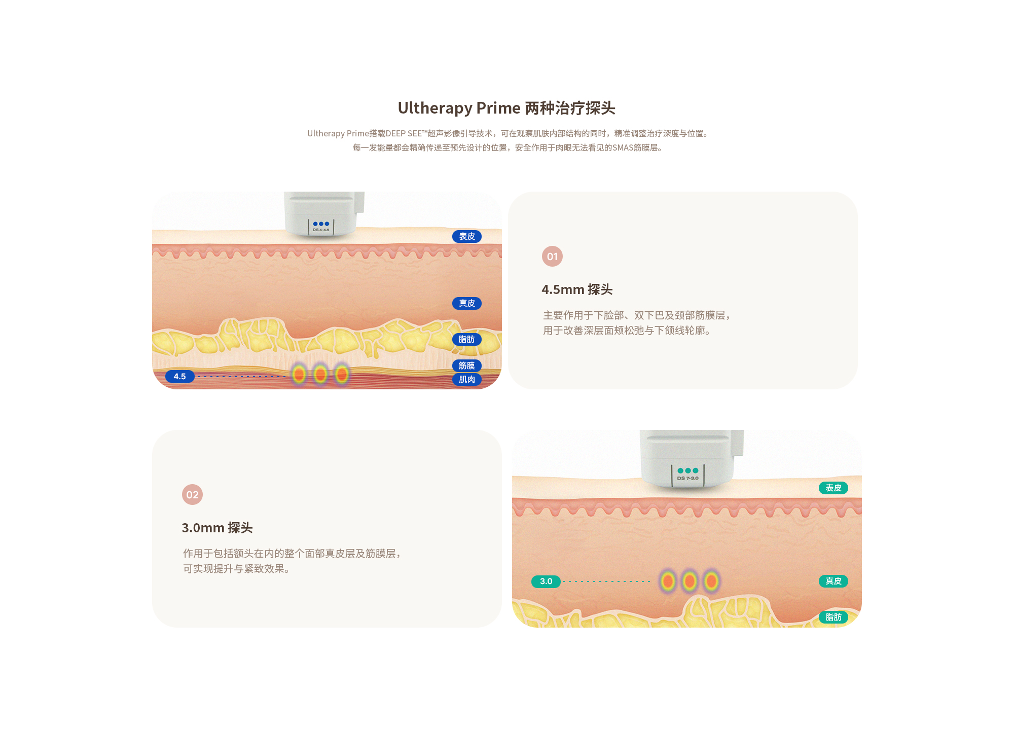 [울쎄라 두가지 핸드피스] (01) 4.5mm 핸드피스 : 하안면부와 이중턱, 목부위의 근막을 타겟으로 시술해 심부볼과 턱라인을 개선하는데 사용됩니다. (02) 3mm 핸드피스 : 이마를 포함한 얼굴 전체의 진피/근막층에 작용해 리프팅과 타이트닝 효과가 있습니다.